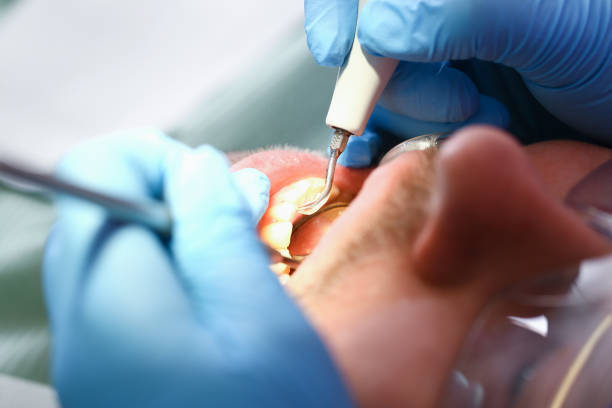 Best Weekend Emergency Dentist in Woodstock, GA
